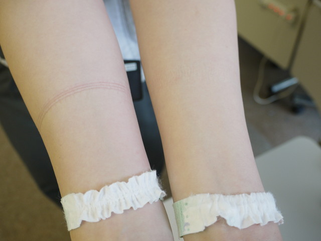 ユニ・チャーム工場見学／右がムーニー エアフィット、左が従来製品。45分間腕に付けた結果 