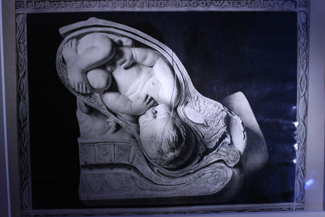 美しいけど怖い!「医療器具展」の展示物