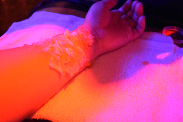 超絶叫! 六本木『怪談BARスリラーナイト』傷メイクの作り方(その3)~腕にたらすと一気に固まり…