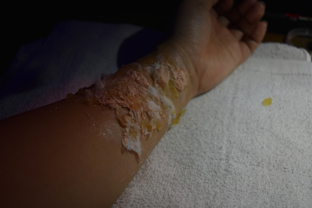 超絶叫! 六本木『怪談BARスリラーナイト』傷メイクの作り方（その4）～なんとも気持ち悪いでこぼこが！～