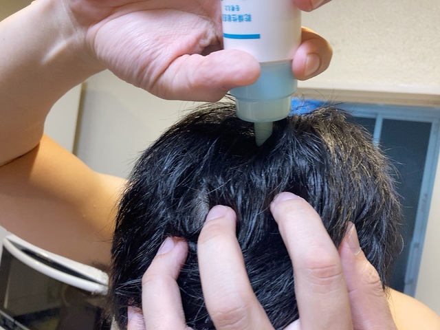 【キュレル 頭皮保湿ローション】頭皮の潤い対策は育毛にも、フケケアにも重要