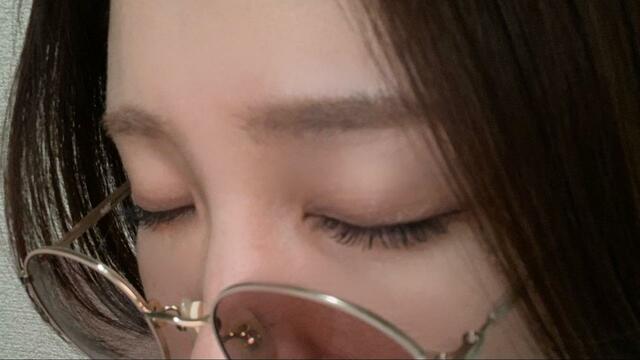 【メガネのばんそうこう　ぱふっと】装着5分後。跡はほとんど付きませんでした