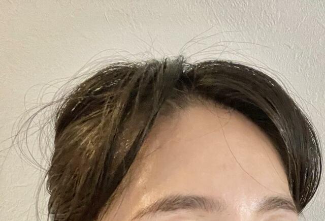 【ダイソー　前髪ふんわりカーラー使用後】前髪が長い私に「前髪ふんわりカーラー」はNGでした
