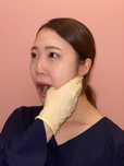耳下腺マッサージ