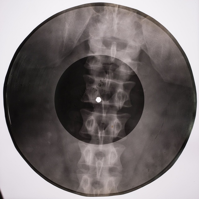 ボーン・レコード　Ⓒ Photography: Xray Audio Project / Paul Heartfield