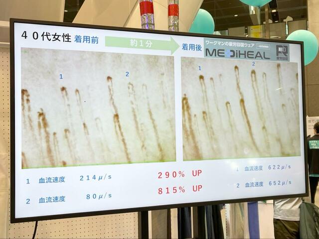 【ワークマン メディヒール(R)シリーズ】40代女性の効果レポート！血流速度の増加率に驚きです