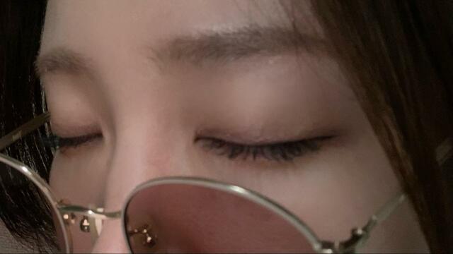 【メガネのばんそうこう　ぱふっと】装着１０分後。少し赤みがある程度