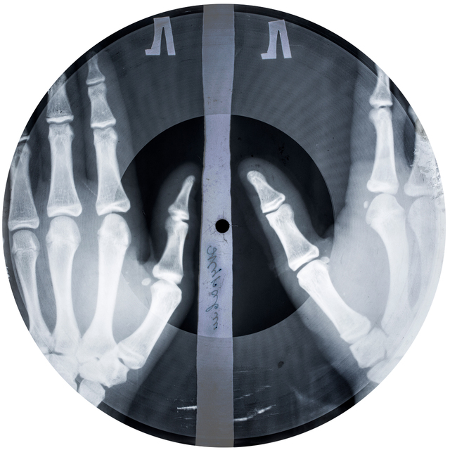 ボーン・レコード　Ⓒ Photography: Xray Audio Project / Paul Heartfield