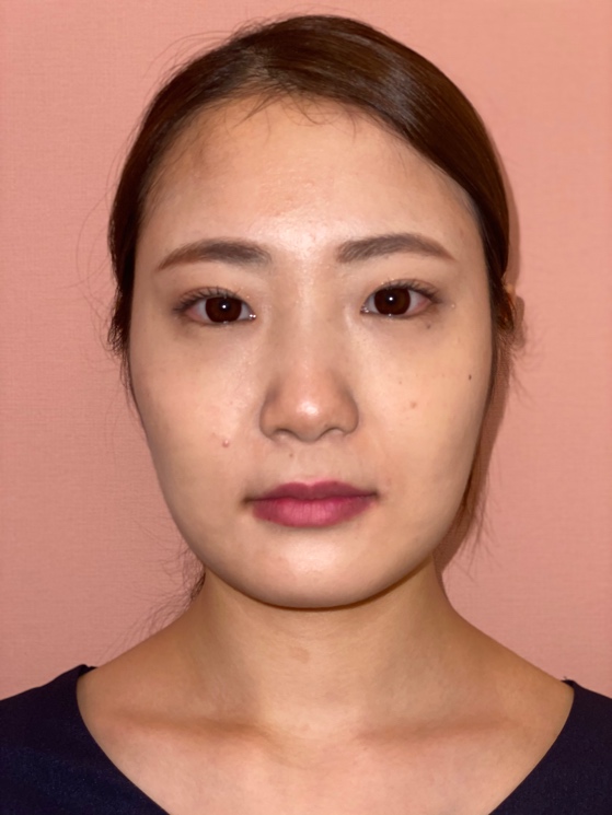 笑顔トレーニングを行う前